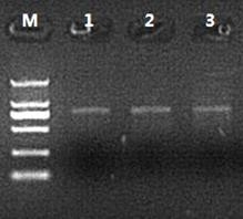 cDNA 第二链合成